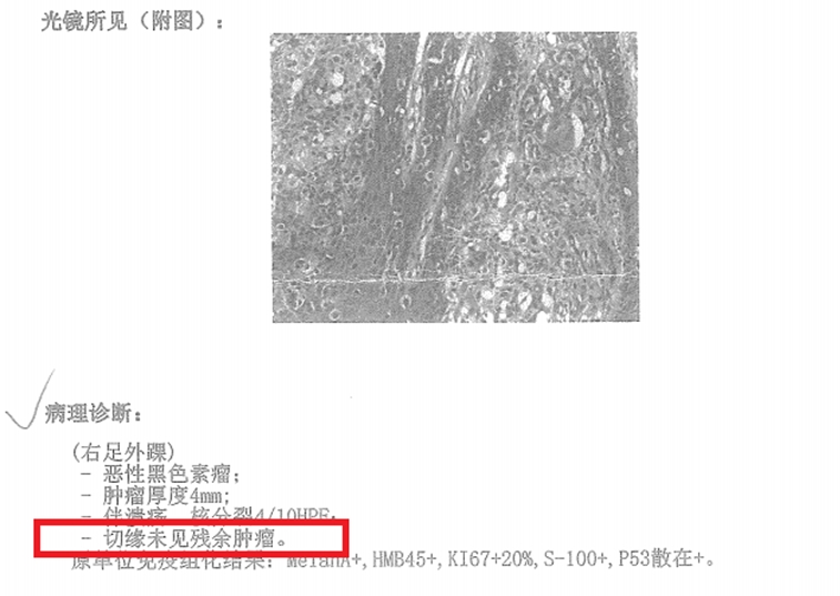 肿瘤医院病理报告.jpg