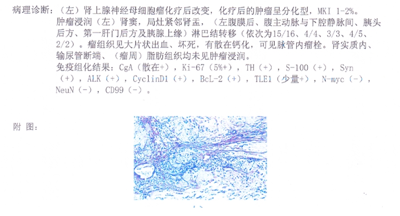 病理报告.jpg