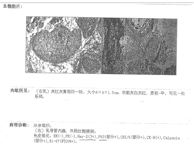 病理报告.jpg