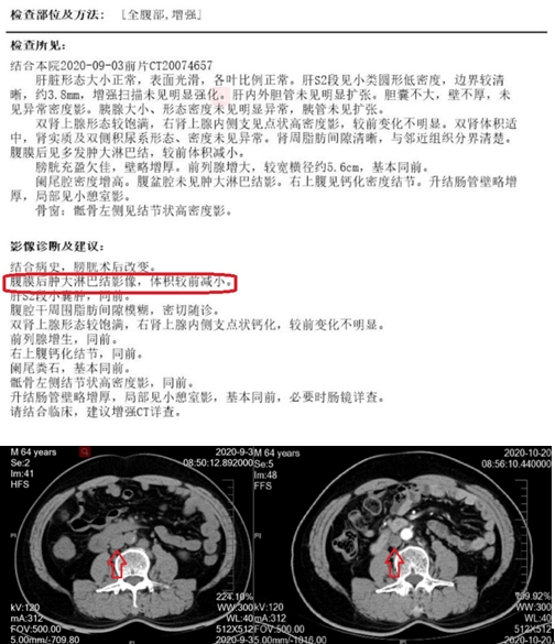 美国治疗方案.jpg