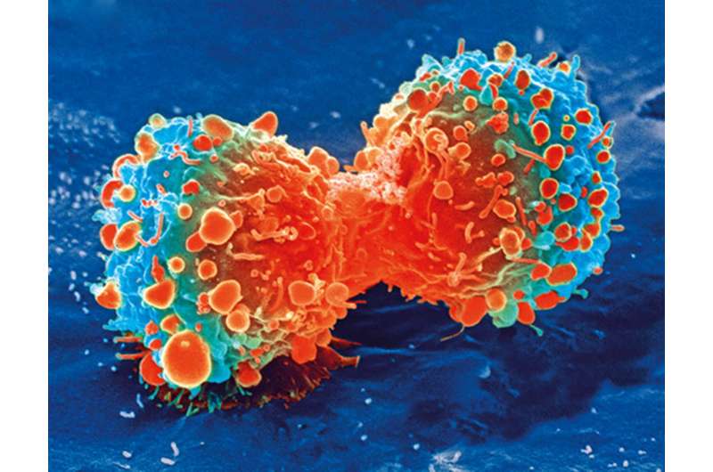 洞察肠癌的早期阶段，可提供新的治疗方法