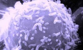 新技术揭示单个癌细胞对脂肪酸的胃口不同