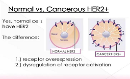 HER-2低表达乳腺癌：仍可使用抗体偶联药物