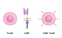 CAR T疗法在难治性前列腺癌中初露端倪