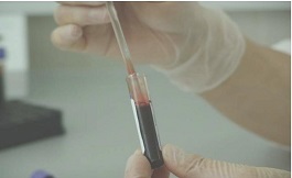 等离子体在白血病治疗中的潜在作用