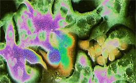 科学家发现了部分癌症转移的起源