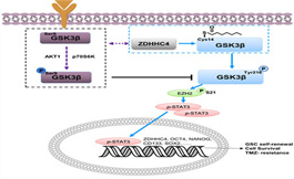 GSK3β棕榈酰化对胶质母细胞瘤的促进作用