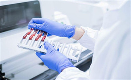 AIDS 淋巴瘤中低白蛋白血症的预后可能更差