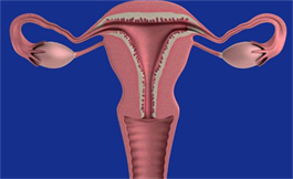 卵巢癌监测可诊断出 BRCA 基因有缺陷的女性