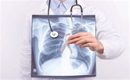 海外医疗：专家敦促符合条件的人接受肺癌筛查