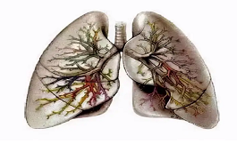 研究揭示了一些肺炎住院后残余肺损伤的程度