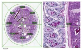 科学家强调了有害肠道细菌在患者发烧中的作用