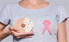 出国看病：基因突变可能会带来乳腺癌的真正风险