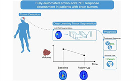 用于 PET 成像的新工具允许对脑肿瘤进行评估