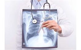 海外医疗：35-54岁的女性肺癌发病率高于男性