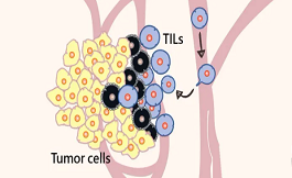 免疫耐药黑色素瘤：二代TILs疗法，疾病控制率100%