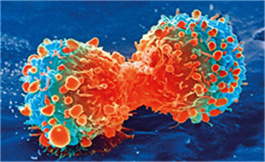 FDA 批准一线 Tislelizumab 加化疗用于不可切除 ESCC
