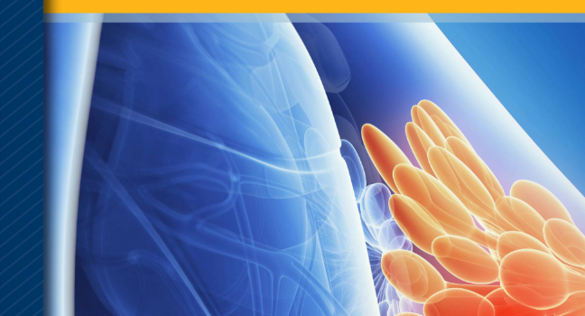 为治疗脑转移性乳腺癌治疗相关性腹泻，寻求Crofelemer孤儿药称号