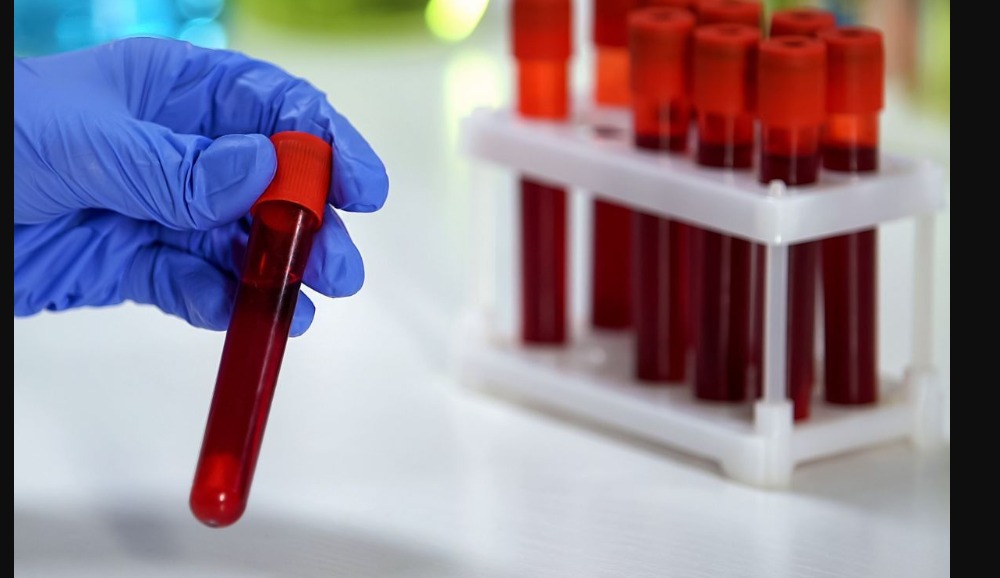 肺癌EGFR罕见突变迎来一线新选择：迪哲舒伏哲替尼3期试验成功